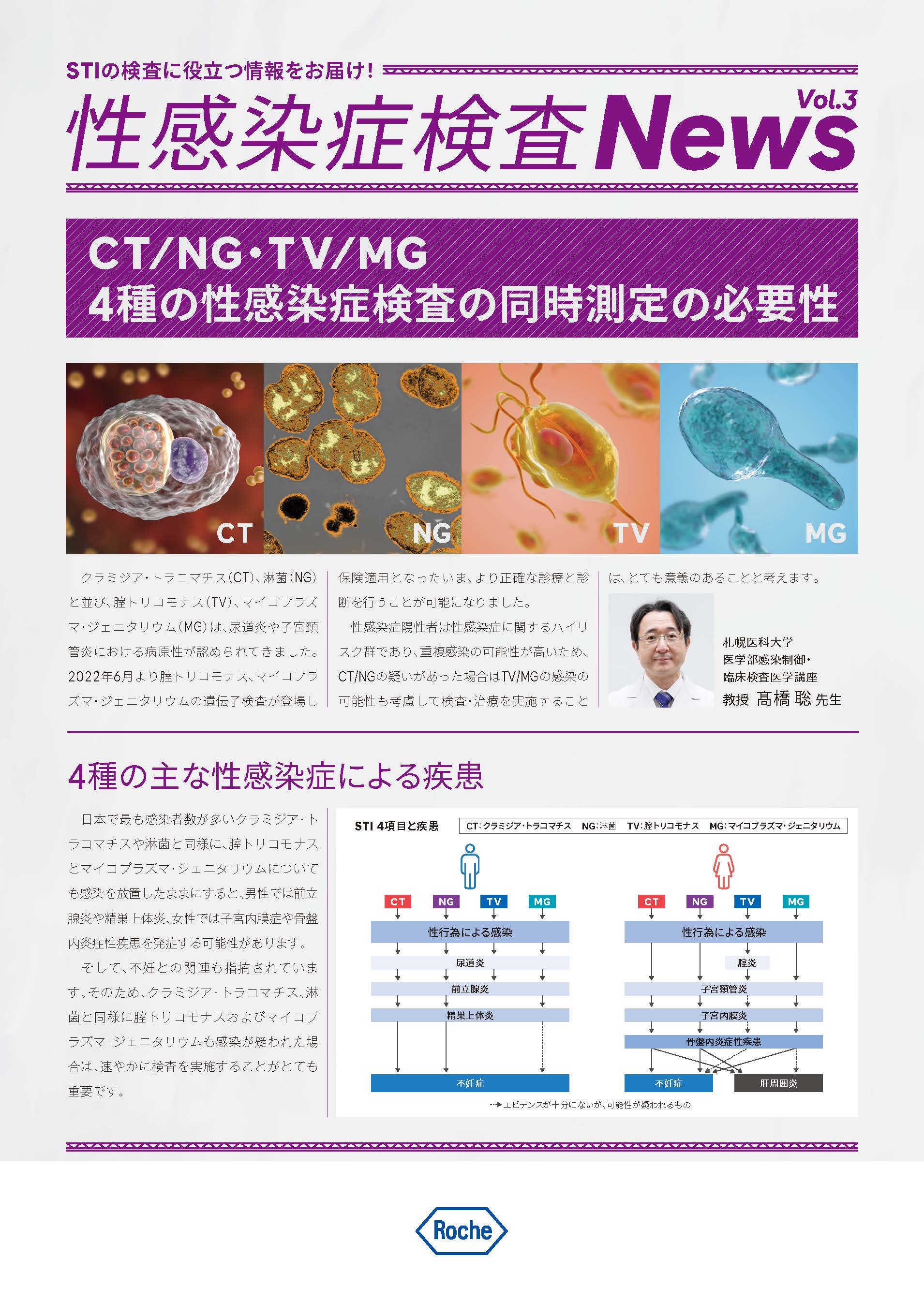 CT⁄NG・TV⁄MG 4種の性感染症検査の同時測定の必要性