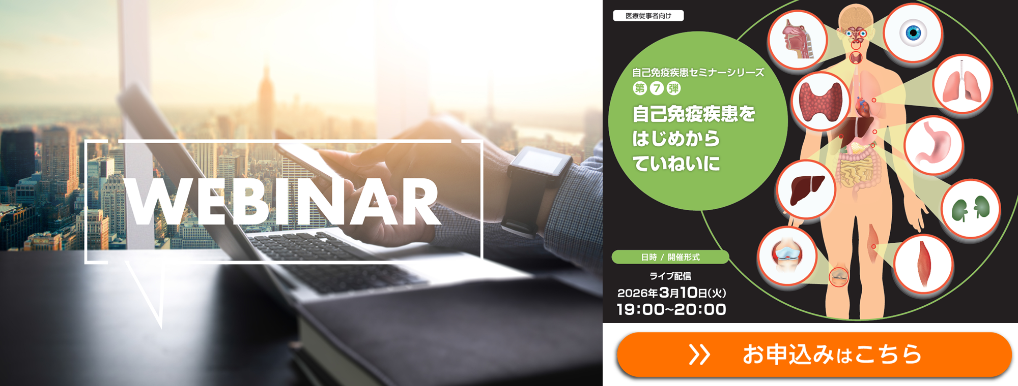 【WEBセミナー】シェーグレン症候群(SS)の検査と診療 自己免疫疾患セミナーシリーズ【第7弾】　